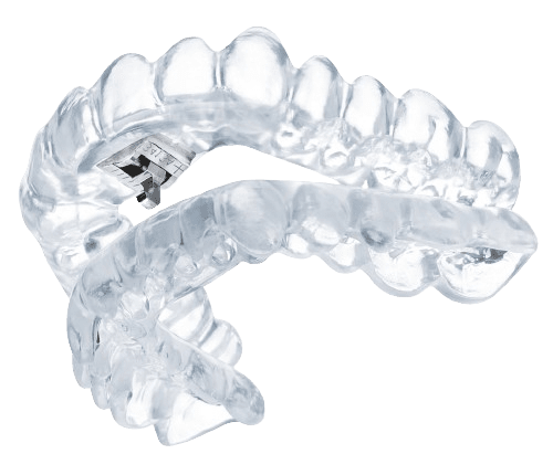 Intelliform Night Guard – H & R Dentaltechnik GmbH
